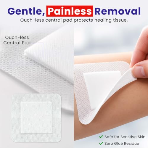 HEALQU Island Dressing - 4"x4", 30 Count - Bordered Gauze Sterile Individually Wrapped Gauze Pads, Water-Resistant, Non-Woven Backing - Soft and Breathable Wound Dressing for First Aid and Medical